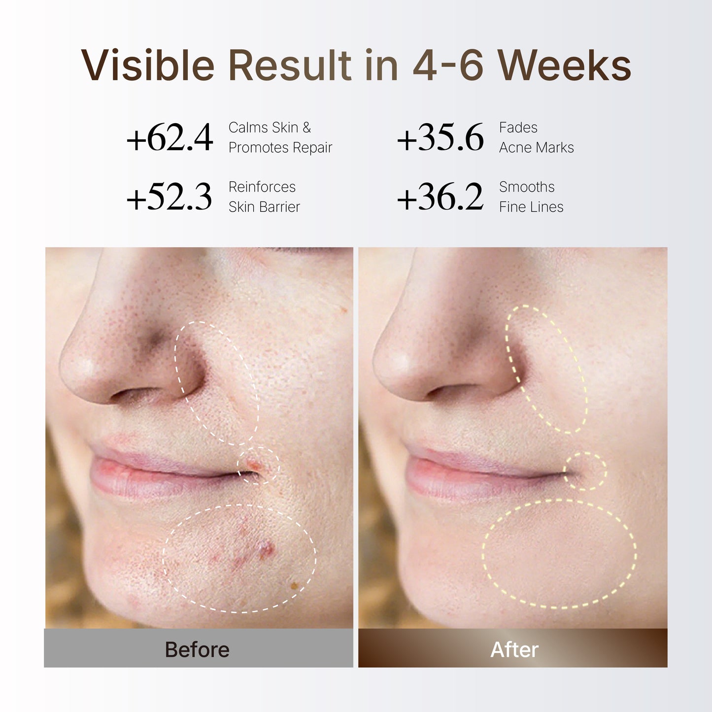 HelloFace Mask Light Therapy Pro 2.0