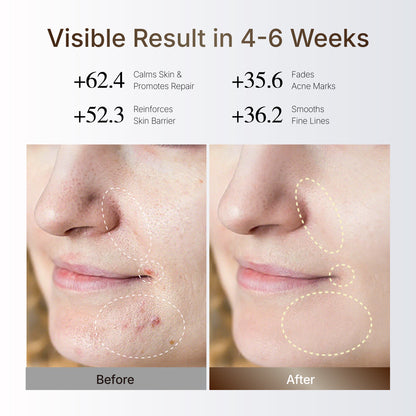 HelloFace Mask Light Therapy Pro 2.0